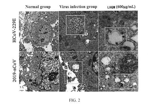 USE OF PHARMACEUTICAL COMPOSITION FOR PREVENTING AND TREATING NOVEL CORONAVIRUS PNEUMONIA — 图样 2 / mark 2 · Laos patent