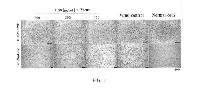 USE OF PHARMACEUTICAL COMPOSITION FOR PREVENTING AND TREATING NOVEL CORONAVIRUS PNEUMONIA — 图样 8 / mark 8 · Laos patent