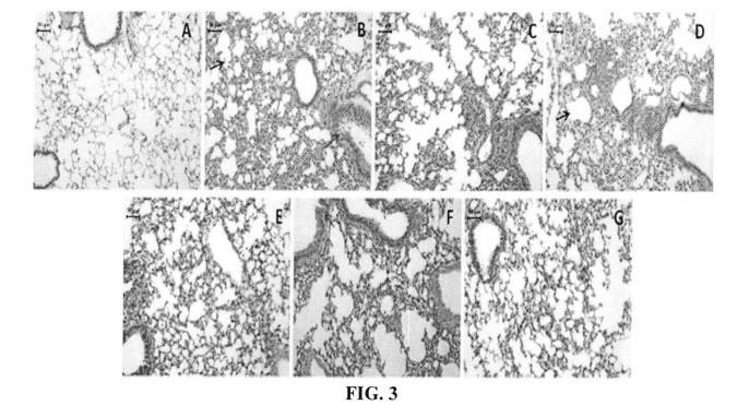 TRADITIONAL CHINESE MEDICINE COMPOSITION FOR TREATING COLD IN CHILDREN — 图样 4 / mark 4 · Laos patent